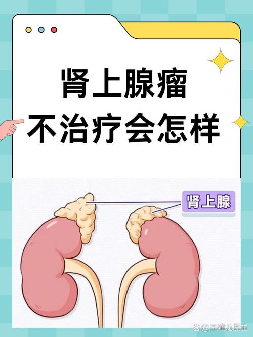 肾上腺腺瘤引起脑梗吗