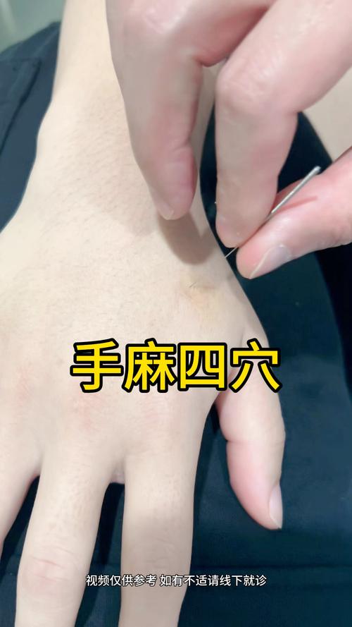 手指末端麻木放血穴位