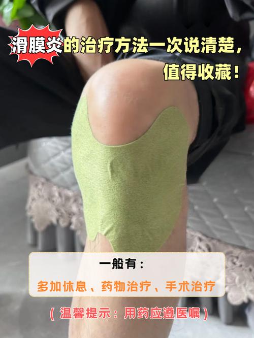 风湿性髋关节滑膜炎治疗