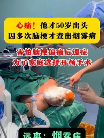 脑梗开颅手术肺部感染