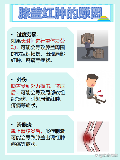 产后风湿关节红肿怎么办