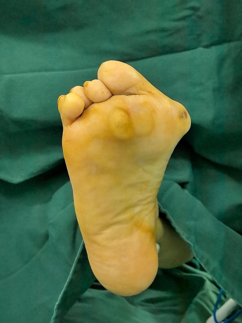 类风湿性关节炎能怀孕吗