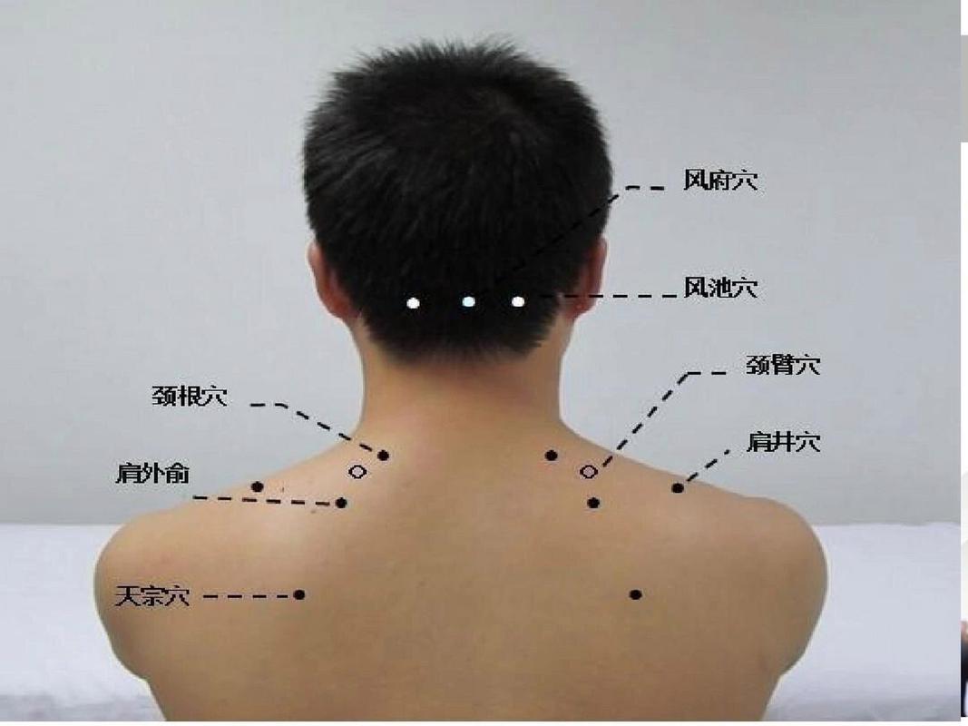 扭了脖子按摩什么穴位