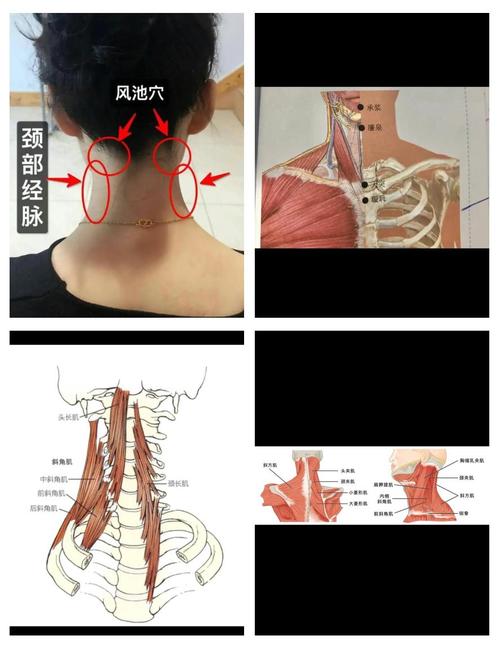 扭了脖子按摩什么穴位