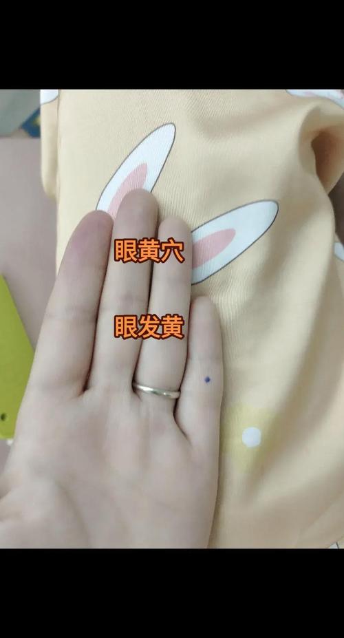 干眼症针灸扎什么穴位