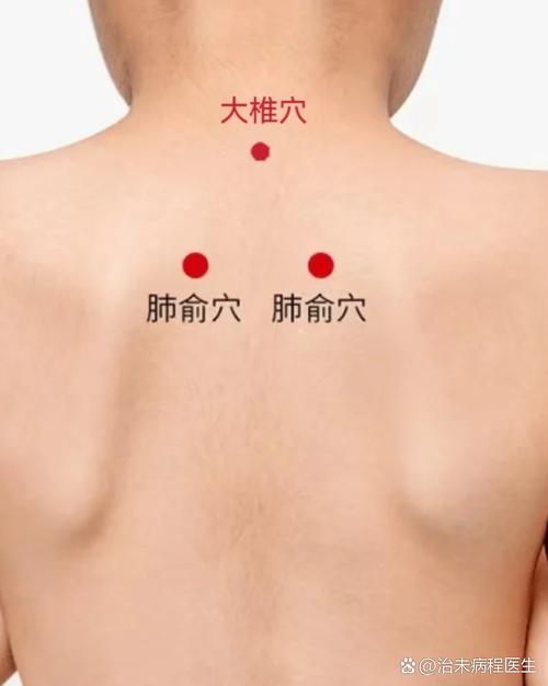 风寒感冒咳嗽艾灸穴位