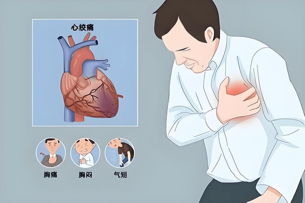 心脏搭桥手术诱发脑梗