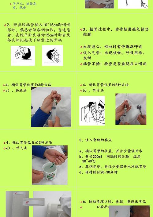 脑梗鼻饲病人存在护理