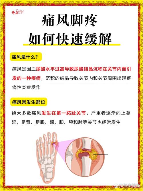 上海怎样治疗风湿关节痛