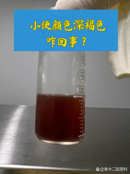 脑梗病人尿液颜色褐色