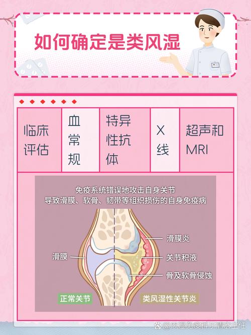 怎样诊断类风湿性关节炎