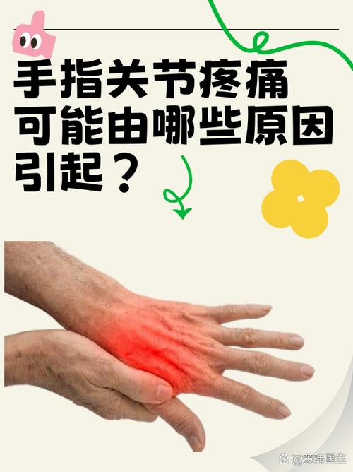 风湿病手指关节疼怎么办