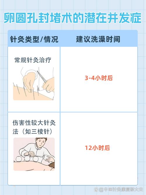 穴位注射多久可以洗澡