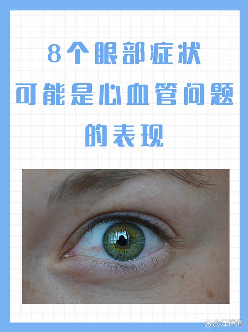 脑梗病人眼睛为啥冰冷