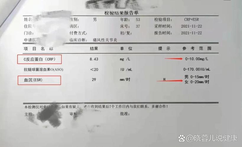 风湿性关节炎的检查项目