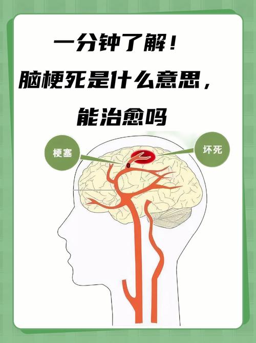 脑梗引起记忆算数障碍