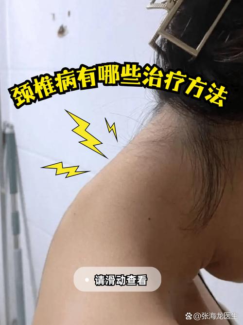 风湿颈椎病的症状有哪些