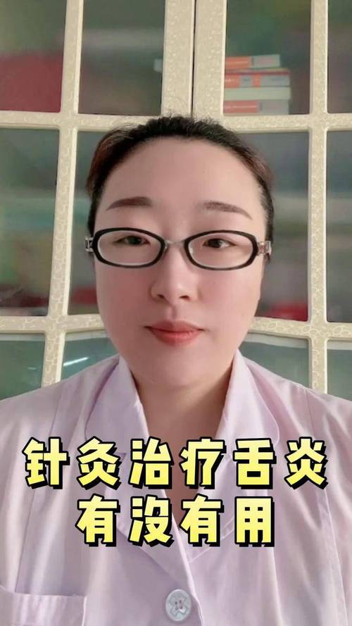 舌头左边生疮 灸穴位