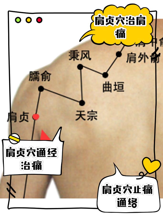 肩周炎按摩哪个穴位好