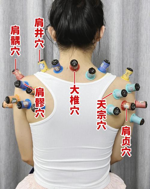 肩周炎按摩哪个穴位好