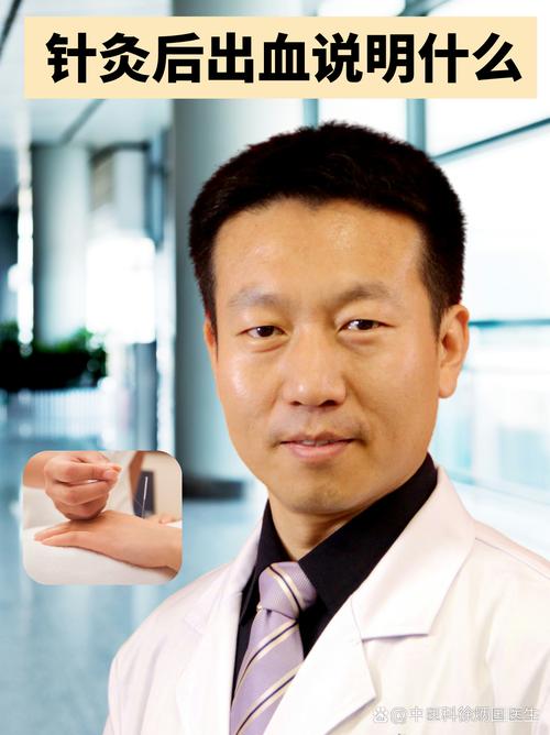 风湿性关节炎医生任德广