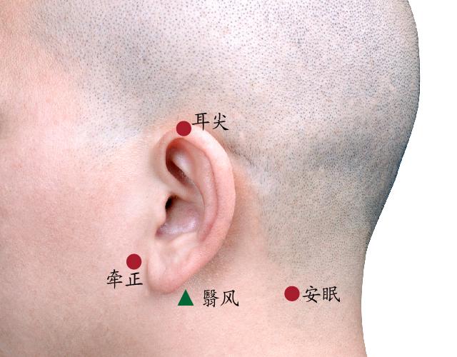 口舌生疮艾灸什么穴位