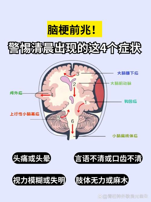 脑梗严重还是脑瘤严重