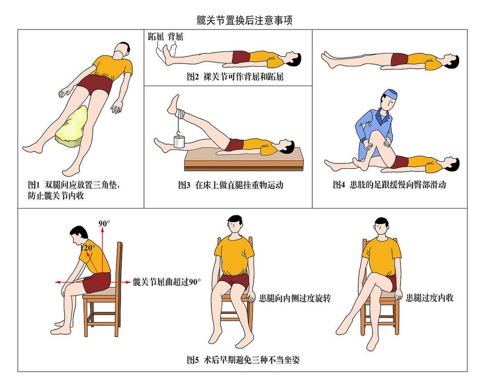 脑梗治疗期间能否锻炼
