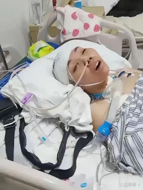 脑梗患者后期出现晕倒