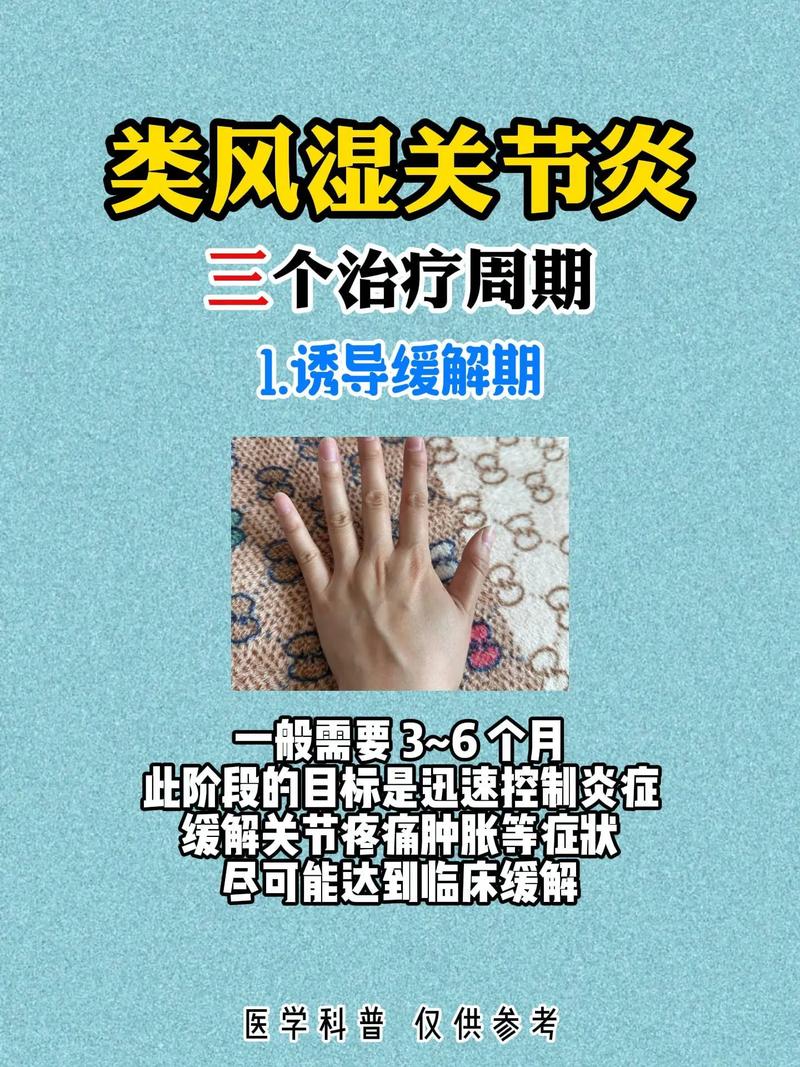 风湿用什么方法可以治好