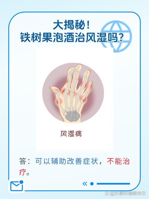 用什么方法可以治好风湿