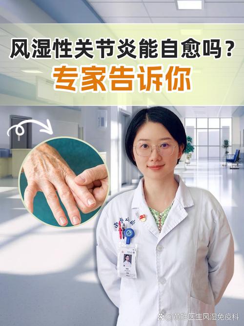 类风湿性关节炎早期治疗