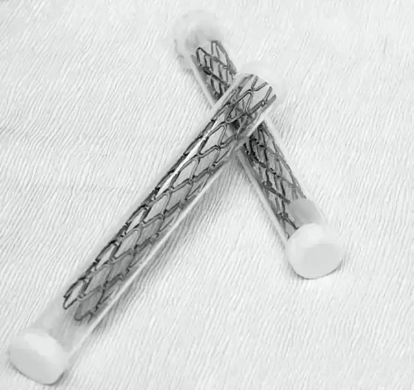 脑梗脖子血管堵塞支架