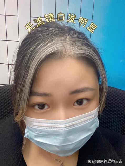 脑梗患者脸色发黑嗜睡