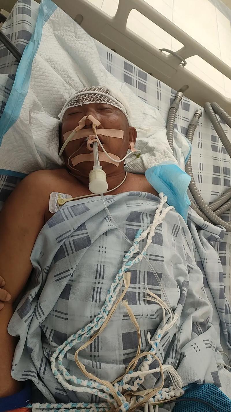 外伤脑出血 引起脑梗