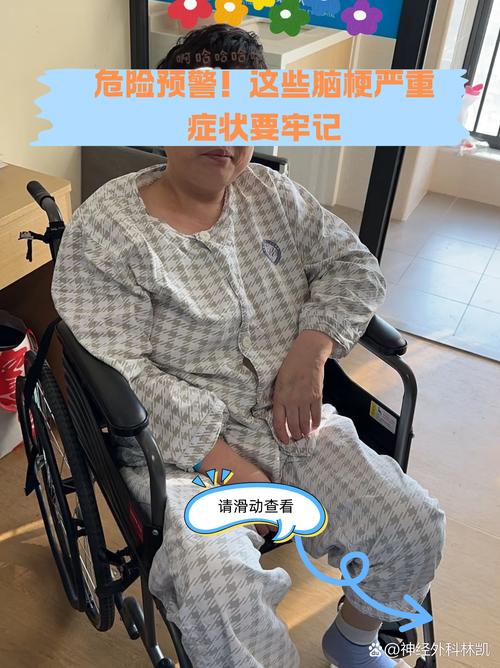 脑梗病人出现肺部感染