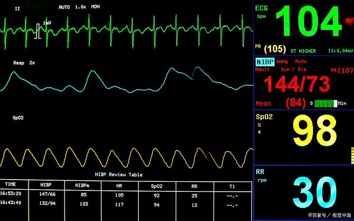 脑梗老人呼吸频率90