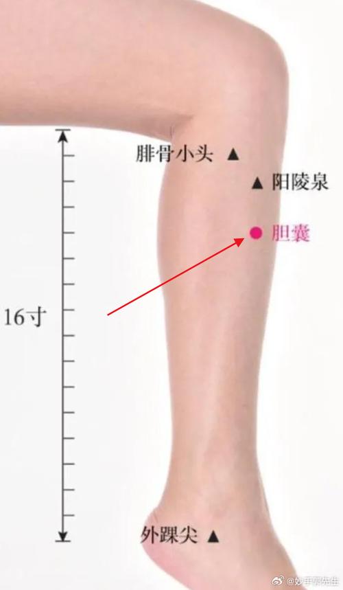 胆红素高针灸哪个穴位