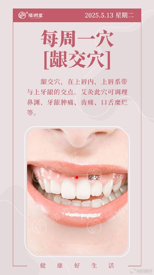 嘴角生疮针灸什么穴位