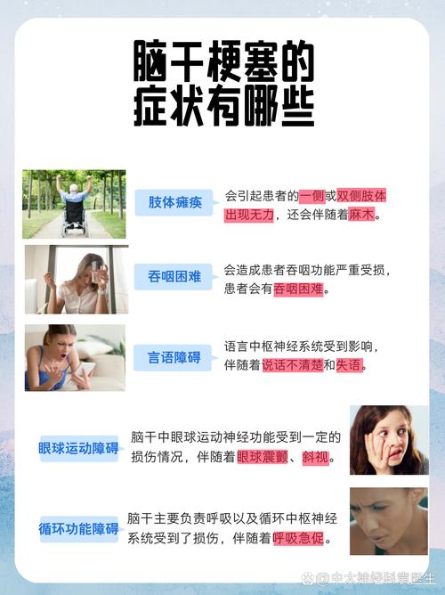 脑梗治疗专家医院在哪