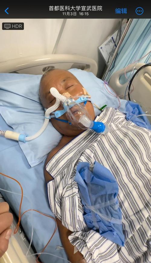 银川康复医院治疗脑梗