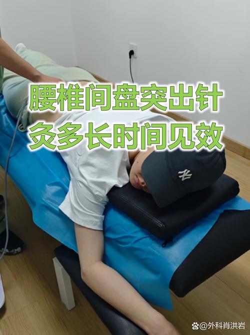 穴位注射治疗腰椎突出