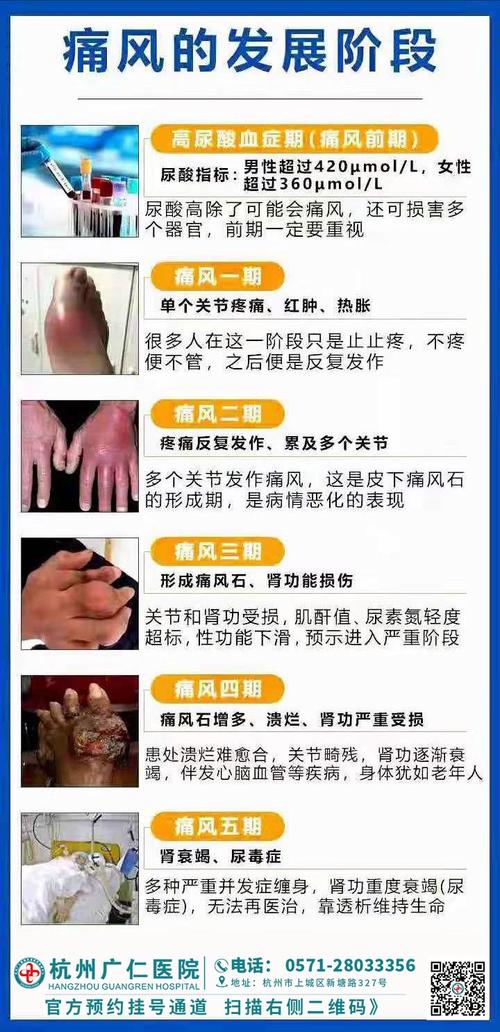 类风湿哪个医院治疗的好