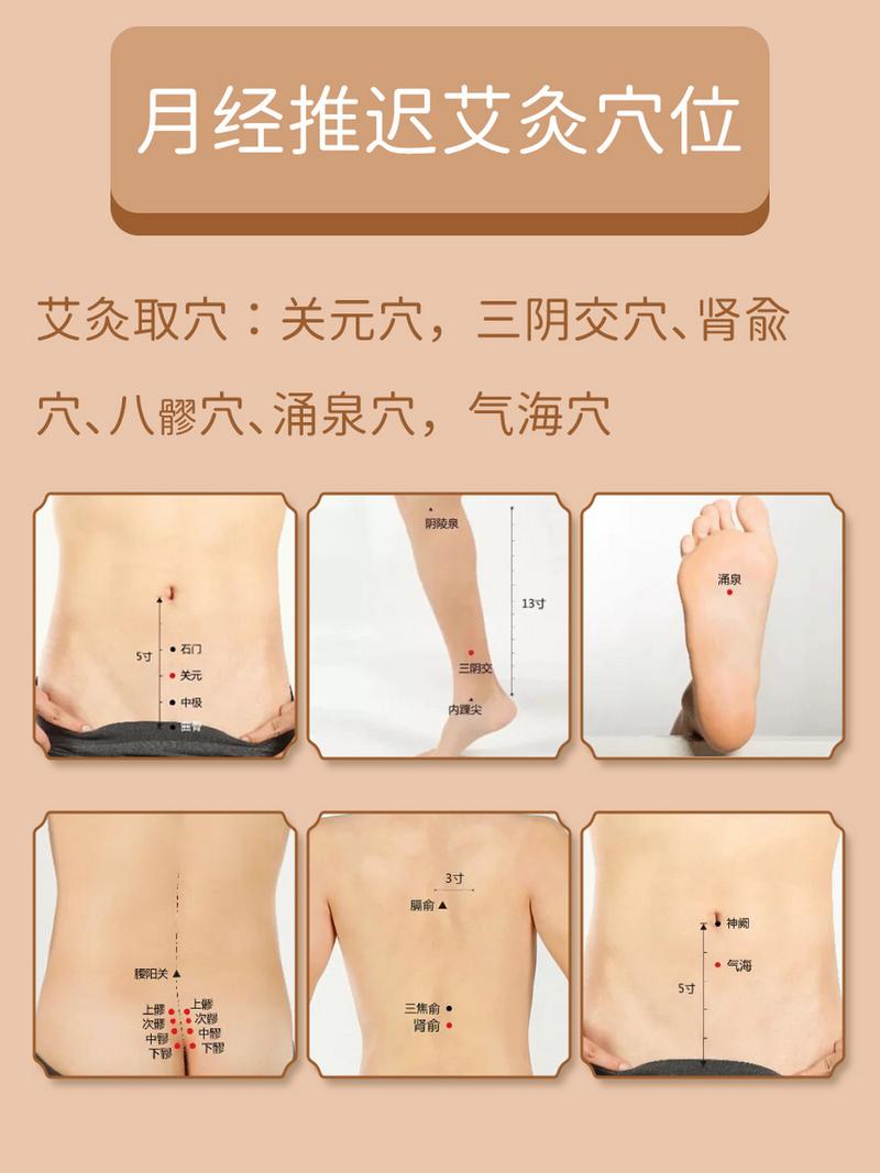 月经推迟艾灸哪个穴位