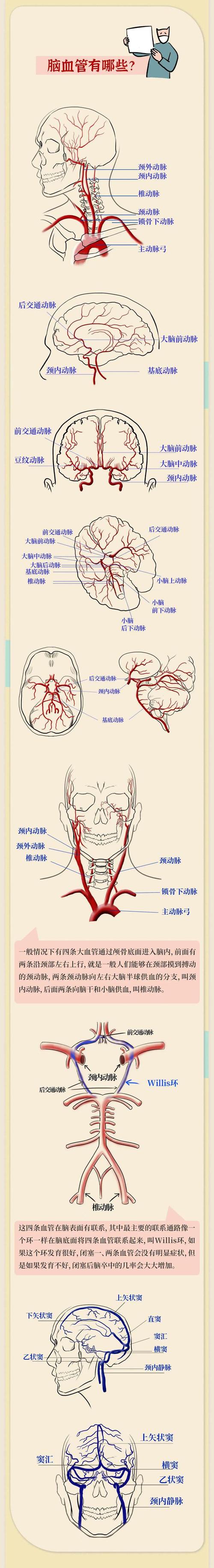 左边脑梗右边血管开始