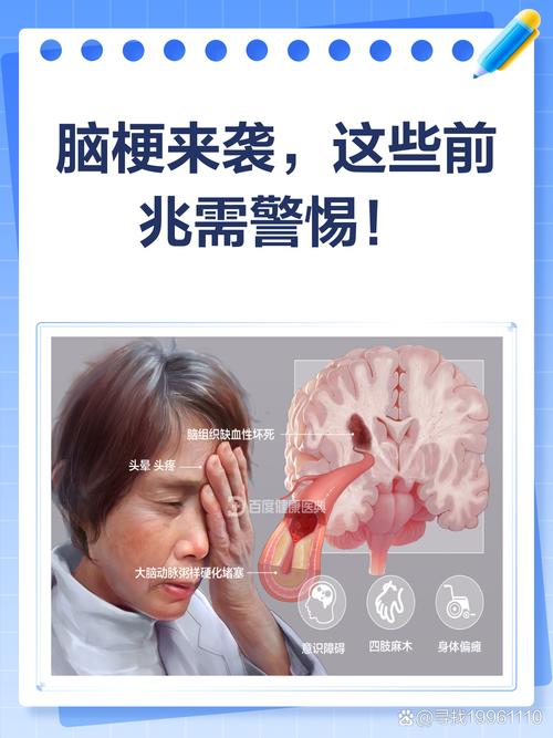 动手打脑梗患者 报警