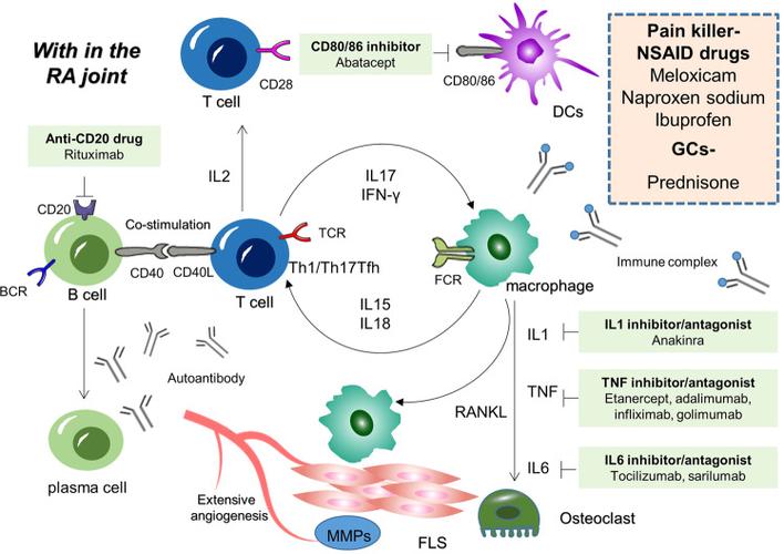 类风湿性关节炎发病机制