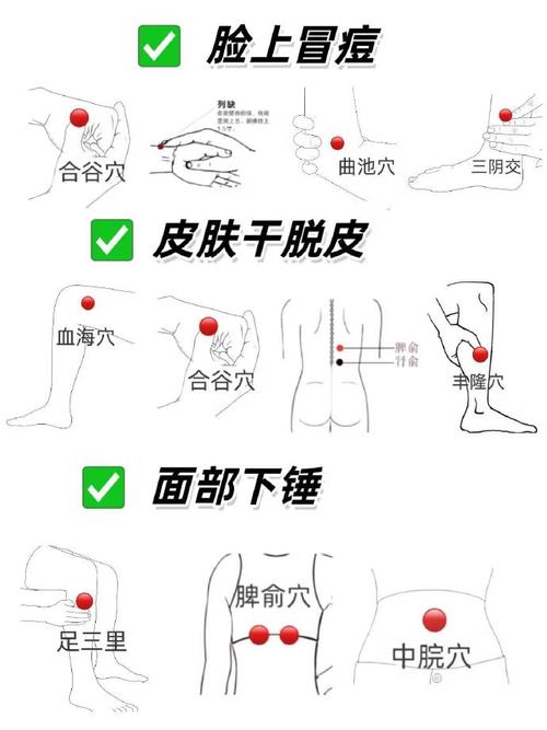 艾灸痘痘面部哪个穴位
