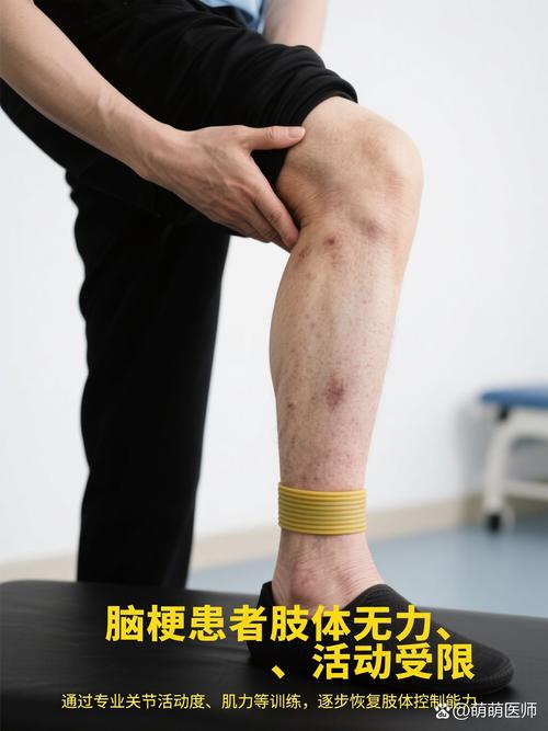 脑梗装好支架手脚无力