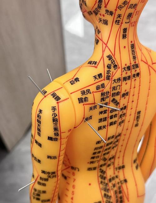 肩周炎治疗按哪些穴位